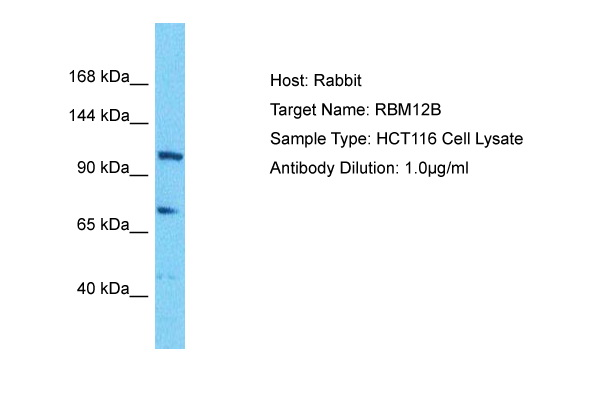 Host: Rabbit Target Name: RBM12B Sample Tissue: Human HCT116 Whole Cell lysates Antibody Dilution: 1ug/ml