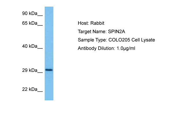 Host: Rabbit Target Name: SPIN2A Sample Tissue: Human COLO205 Whole Cell lysates Antibody Dilution: 1ug/ml