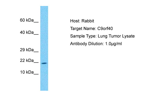 Host: Rabbit Target Name: C9ORF40 Sample Tissue: Human Lung Tumor lysates Antibody Dilution: 1ug/ml