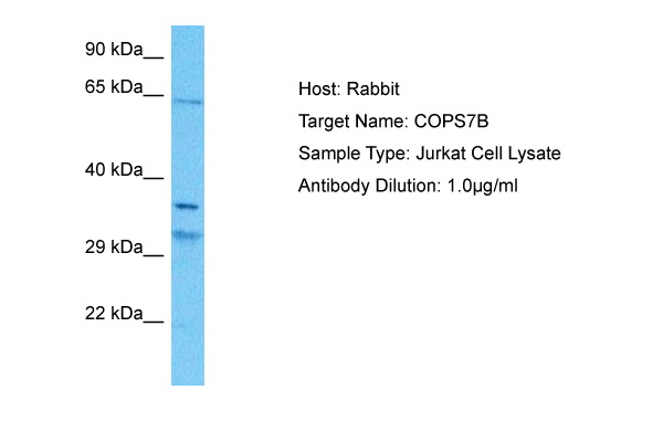 Host: Rabbit Target Name: COPS7B Sample Tissue: Human Jurkat Whole Cell lysates Antibody Dilution: 1ug/ml