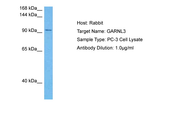 Host: Rabbit Target Name: GARNL3 Sample Tissue: Human PC-3 Whole Cell lysates Antibody Dilution: 1ug/ml