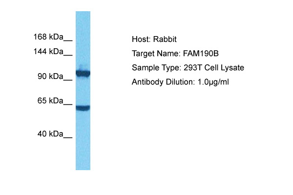 Host: Rabbit Target Name: FAM190B Sample Tissue: Human 293T Whole Cell lysates Antibody Dilution: 1ug/ml