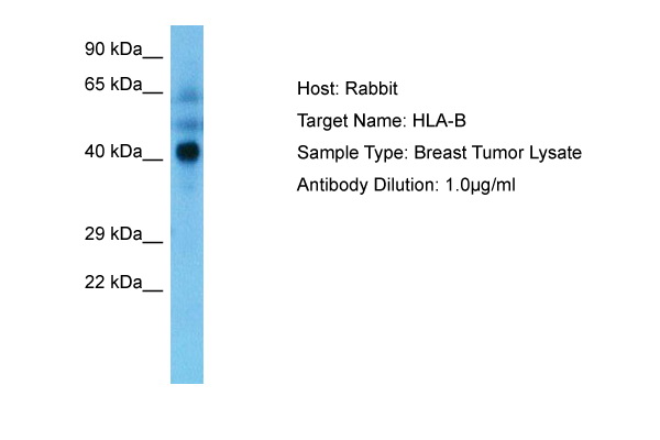 Western blotting analysis of EGFR (phospho-Tyr992) by mouse monoclonal antibody EM-12 in EGF-treated A431 (A), CALU-3 (B), MCF-7 (C), Jurkat (D) and Ramos (E) cell lines (reduced conditions).