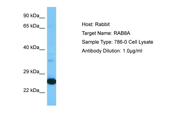 Host: Rabbit Target Name: RAB8A Sample Tissue: Human 786-0 Whole Cell lysates Antibody Dilution: 1ug/ml