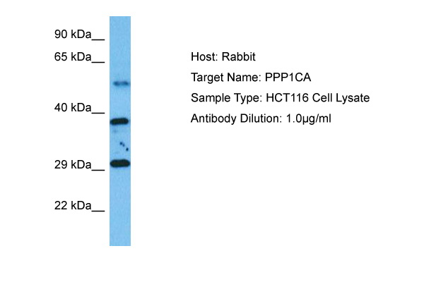 Surface staining of murine monocytes using anti-CD11a monoclonal antibody (cloneM17/4) FITC.
