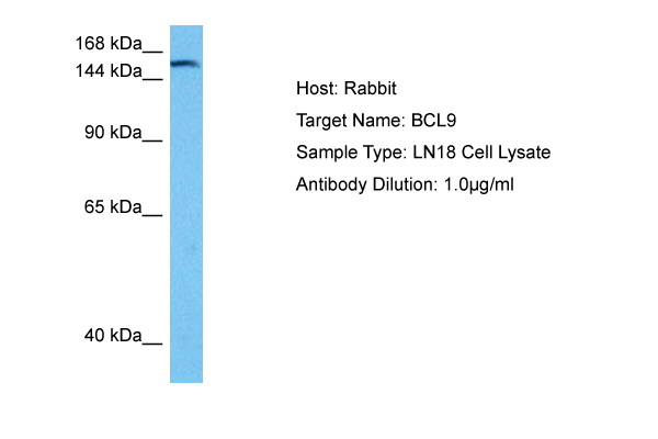 Host: Rabbit Target Name: BCL9 Sample Tissue: Human LN18 Whole Cell lysates Antibody Dilution: 1ug/ml