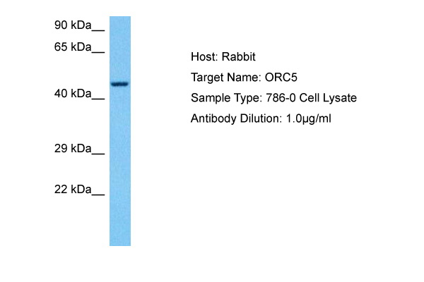 Host: Rabbit Target Name: ORC5 Sample Tissue: Human 786-0 Whole Cell lysates Antibody Dilution: 1ug/ml