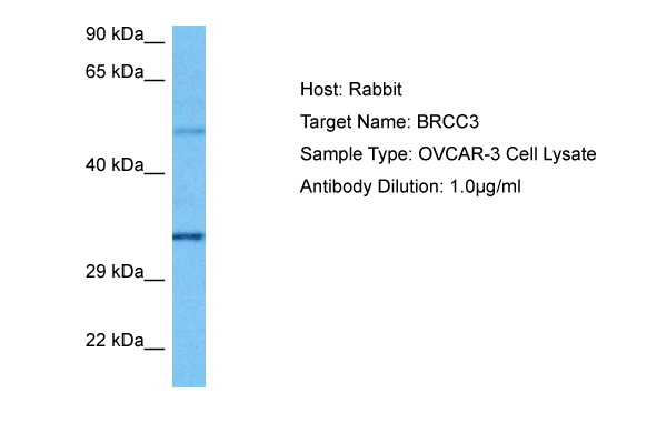 Host: Rabbit Target Name: BRCC3 Sample Tissue: Human OVCAR-3 Whole Cell lysates Antibody Dilution: 1ug/ml