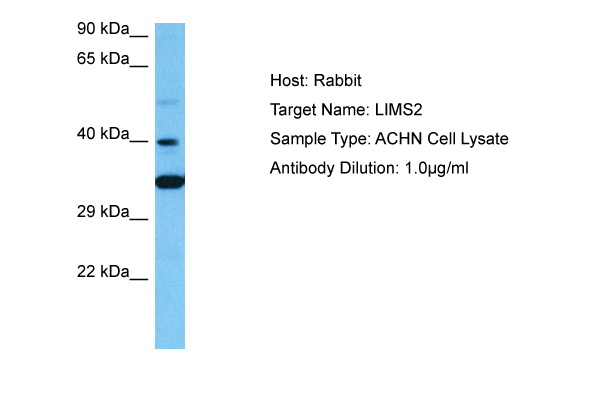 Host: Rabbit Target Name: LIMS2 Sample Tissue: Human ACHN Whole Cell lysates Antibody Dilution: 1ug/ml