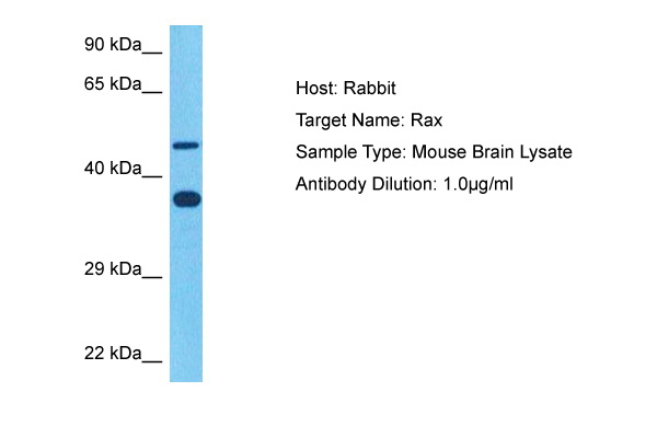 Host: Rabbit Target Name: RAX Sample Tissue: Mouse Brain lysates Antibody Dilution: 1ug/ml