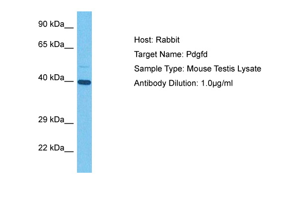 Host: Rabbit Target Name: PDGFD Sample Tissue: Mouse Testis lysates Antibody Dilution: 1ug/ml