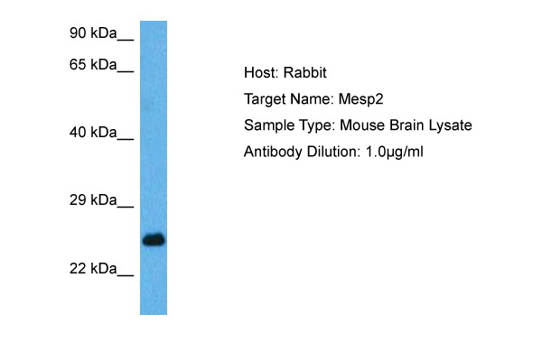 Host: Rabbit Target Name: MESP2 Sample Tissue: Mouse Brain lysates Antibody Dilution: 1ug/ml