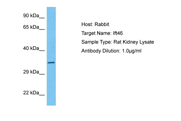 Host: Rabbit Target Name: IFT46 Sample Tissue: Rat Kidney lysates Antibody Dilution: 1ug/ml