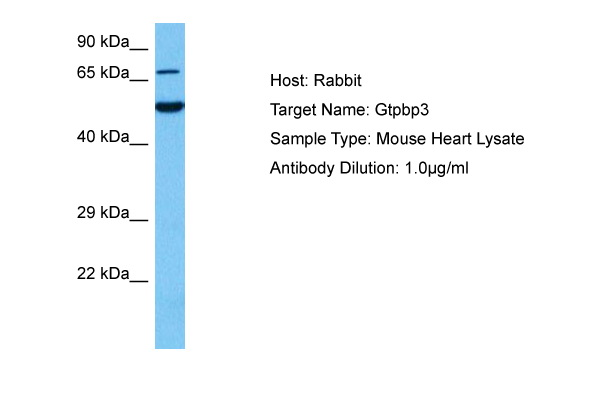 Host: Rabbit Target Name: GTPBP3 Sample Tissue: Mouse Heart lysates Antibody Dilution: 1ug/ml