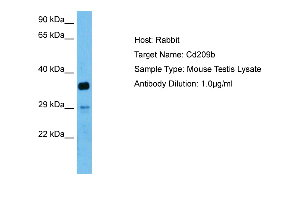 Host: Rabbit Target Name: CD209B Sample Tissue: Mouse Testis lysates Antibody Dilution: 1ug/ml