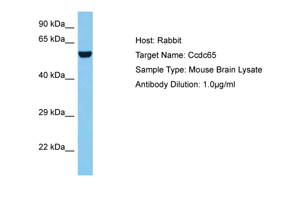 Host: Rabbit Target Name: CCDC65 Sample Tissue: Mouse Brain lysates Antibody Dilution: 1ug/ml