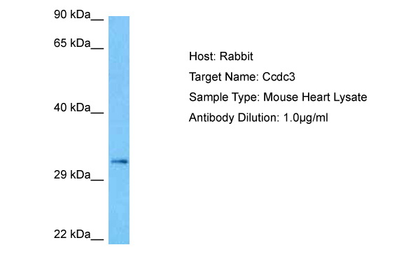 Host: Rabbit Target Name: CCDC3 Sample Tissue: Mouse Heart lysates Antibody Dilution: 1ug/ml