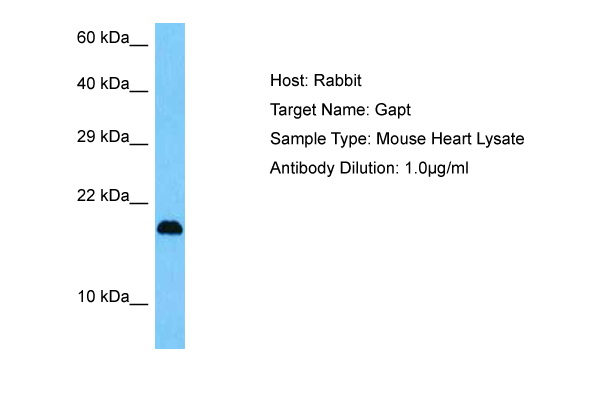 Host: Rabbit Target Name: GAPT Sample Tissue: Mouse Heart lysates Antibody Dilution: 1ug/ml