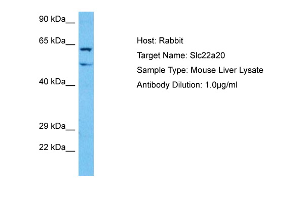Host: Rabbit Target Name: SLC22A20 Sample Tissue: Mouse Liver lysates Antibody Dilution: 1ug/ml