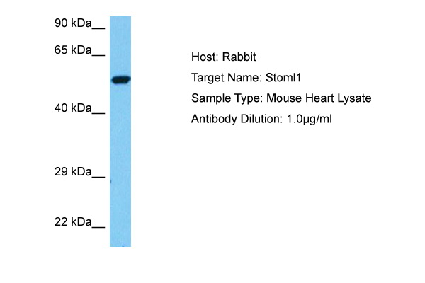 Host: Rabbit Target Name: STOML1 Sample Tissue: Mouse Heart lysates Antibody Dilution: 1ug/ml