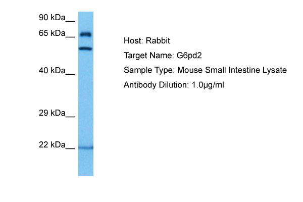 Host: Rabbit Target Name: G6PD2 Sample Tissue: Mouse Small Intestine lysates Antibody Dilution: 1ug/ml