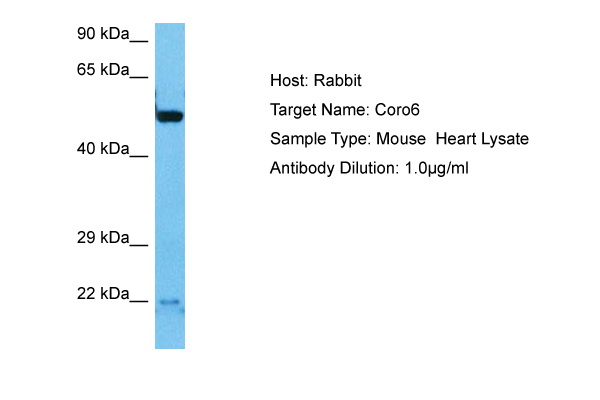 Host: Rabbit Target Name: CORO6 Sample Tissue: Mouse Heart lysates Antibody Dilution: 1ug/ml