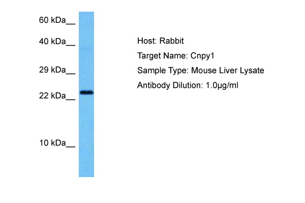 Host: Rabbit Target Name: CNPY1 Sample Tissue: Mouse Liver lysates Antibody Dilution: 1ug/ml