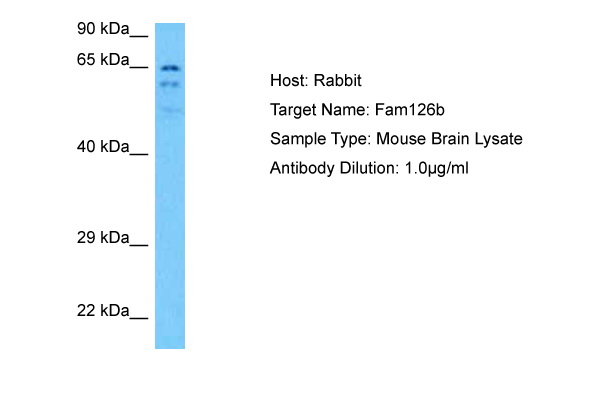 Detection of Abeta 42 peptide using antibody Clone 10C11 at 2 g/ml dilution
