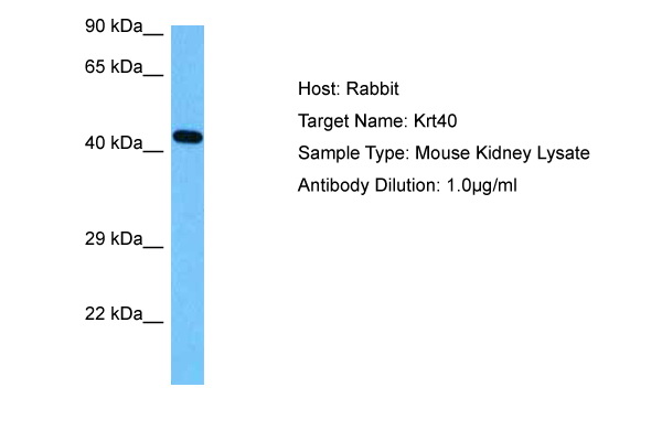 Host: Rabbit Target Name: KRT40 Sample Tissue: Mouse Kidney lysates Antibody Dilution: 1ug/ml