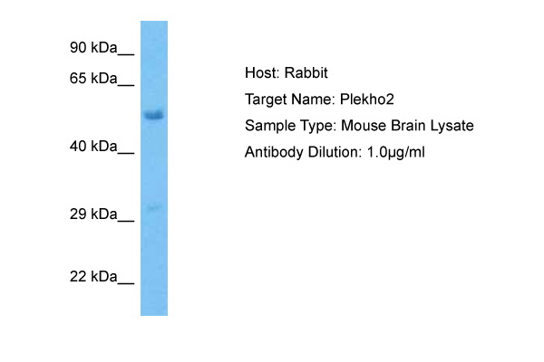 Host: Rabbit Target Name: PLEKHO2 Sample Tissue: Mouse Brain lysates Antibody Dilution: 1ug/ml