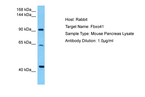 Host: Rabbit Target Name: FBXO41 Sample Tissue: Mouse Pancreas lysates Antibody Dilution: 1ug/ml
