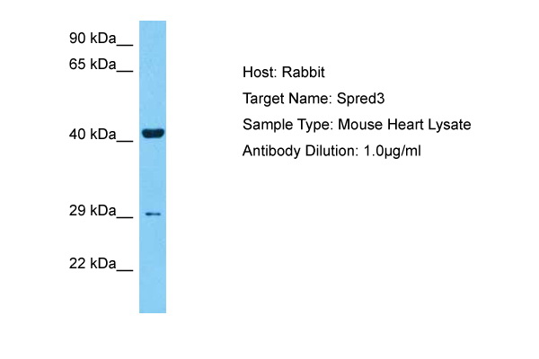 Host: Rabbit Target Name: SPRED3 Sample Tissue: Mouse Heart lysates Antibody Dilution: 1ug/ml