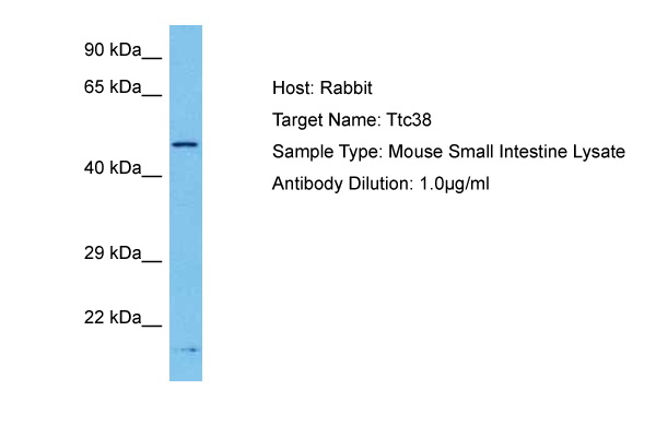 Host: Rabbit Target Name: TTC38 Sample Tissue: Mouse Small Intestine lysates Antibody Dilution: 1ug/ml