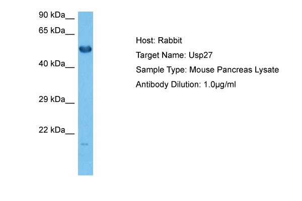 Host: Rabbit Target Name: USP27 Sample Tissue: Mouse Pancreas lysates Antibody Dilution: 1ug/ml
