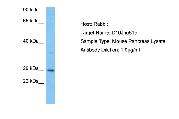 Surface staining of human peripheral blood with anti-human CD300e (UP-H2) APC.