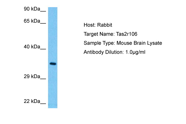 Western blot analysis of OPAL1 in OPAL1-transfected HEK293 cells using mouse monoclonal antibody OPAL1-01.