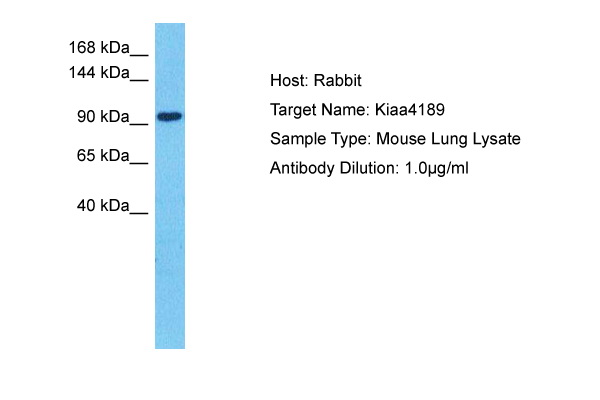 Host: Rabbit Target Name: KIAA4189 Sample Tissue: Mouse Lung lysates Antibody Dilution: 1ug/ml