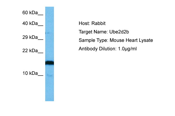SDS-PAGE analysis of purified BEP-5D8 monoclonal antibody.Lane 1: molec ular weight marker, Lane 2: 2 ug of purified BEP-5D8 antibody. Proteins were separated by SDS-PAGE and stained with RAPID StainTM Reagent 3.