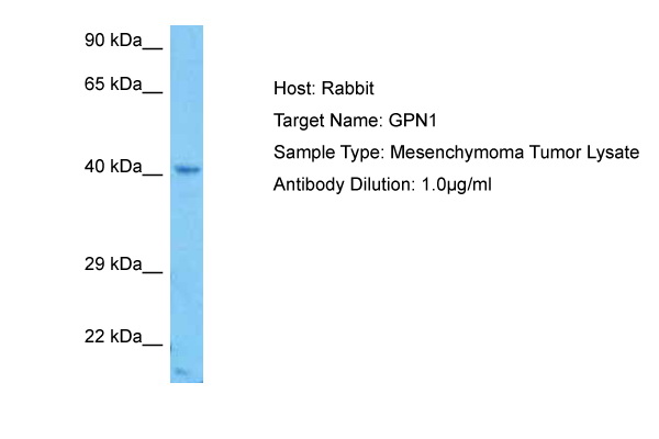 Host: Rabbit Target Name: GPN1 Sample Tissue: Human Mesenchymoma Tumor lysates Antibody Dilution: 1ug/ml
