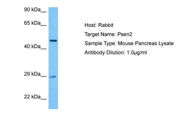 Host: Rabbit Target Name: PSEN2 Sample Tissue: Mouse Pancreas lysates Antibody Dilution: 1ug/ml