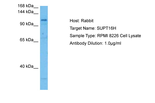 Host: Rabbit Target Name: SUPT16H Sample Tissue: Human RPMI 8226 Whole Cell lysates Antibody Dilution: 1ug/ml