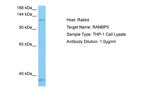 Host: Rabbit Target Name: RANBP5 Sample Tissue: Human THP-1 Whole Cell lysates Antibody Dilution: 1ug/ml