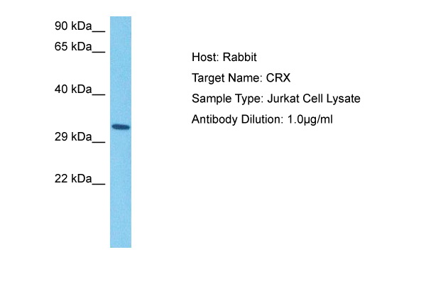 Host: Rabbit Target Name: CRX Sample Tissue: Human Jurkat Whole Cell lysates Antibody Dilution: 1ug/ml
