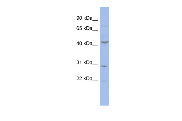 WB Suggested Anti-CCNE2 Antibody Titration: 0.2-1 ug/ml ELISA Titer: 1:312500 Positive Control: OVCAR-3 cell lysateCCNE2 is supported by BioGPS gene expression data to be expressed in OVCAR3