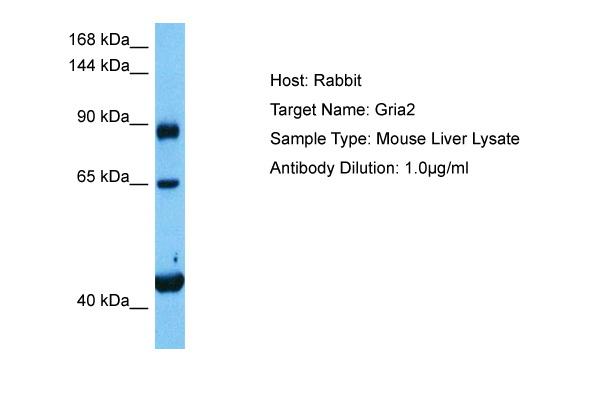 A typical staining pattern with the B-K15 monoclonal antibody of TF1 cell line