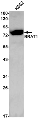 Western blot analysis of BRAT1 in K562 lysates using BRAT1 antibody.