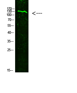 Western blot analysis of Collagen XIX alpha 1 in HELA lysates using Collagen XIX alpha 1 antibody.