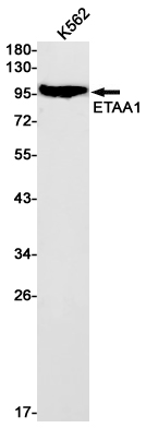 Western blot detection of ETAA1 in K562 cell lysates using ETAA1 Rabbit mAb(1:1000 diluted).Predicted band size:103kDa.Observed band size:103kDa.