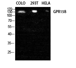Western blot analysis of GPR158 in COLO, 293T, HELA lysates using GPR158 antibody.