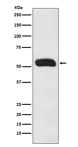 Western blot analysis of Human IgG in Human plasma lysates using Human IgG antibody.